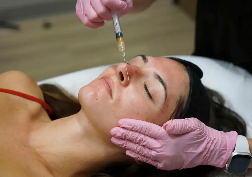 Close-up of a cosmetic injectable treatment being administered on the forehead