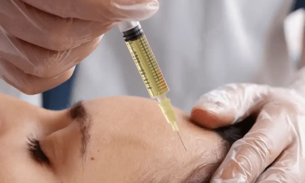 Close-up of a cosmetic injectable treatment being administered on the forehead