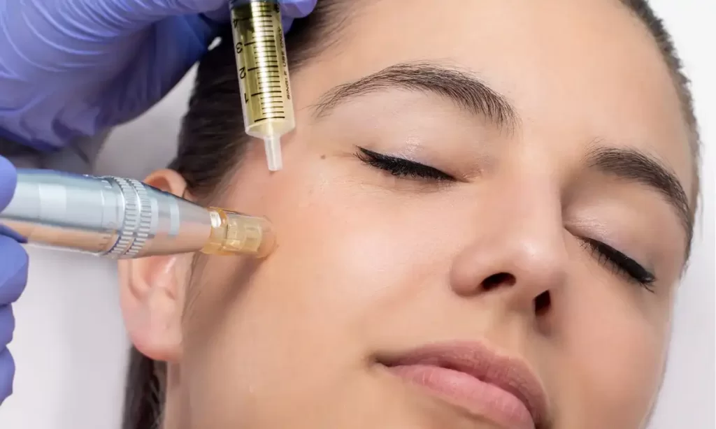 Microneedling with serum infusion treatment being performed on a woman's cheek at Emara Skin Clinic