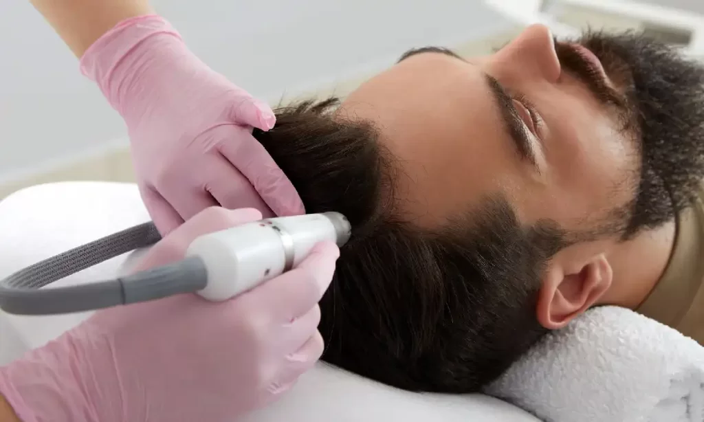Specialist performing hair PRP therapy on a man's scalp at Emara Skin Clinic