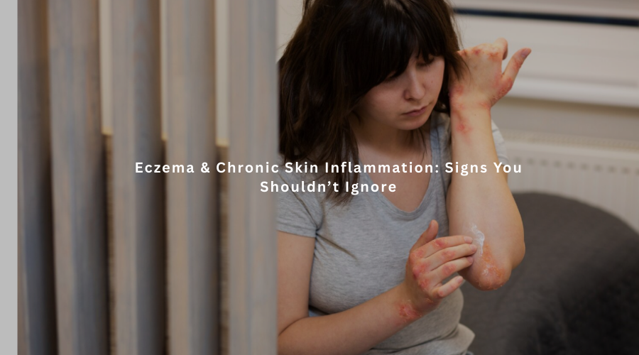 Eczema & Chronic Skin Inflammation: Signs You Shouldn’t Ignore