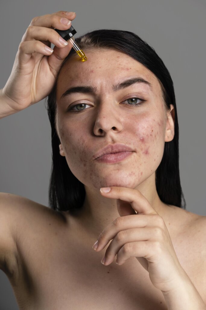 Woman applying serum for pigmentation treatment on face