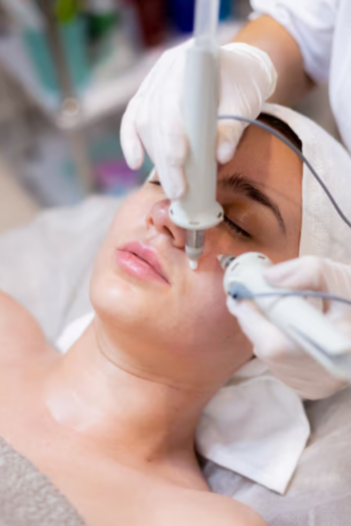 Acne treatment in Delhi by expert dermatologist for clear and healthy skin