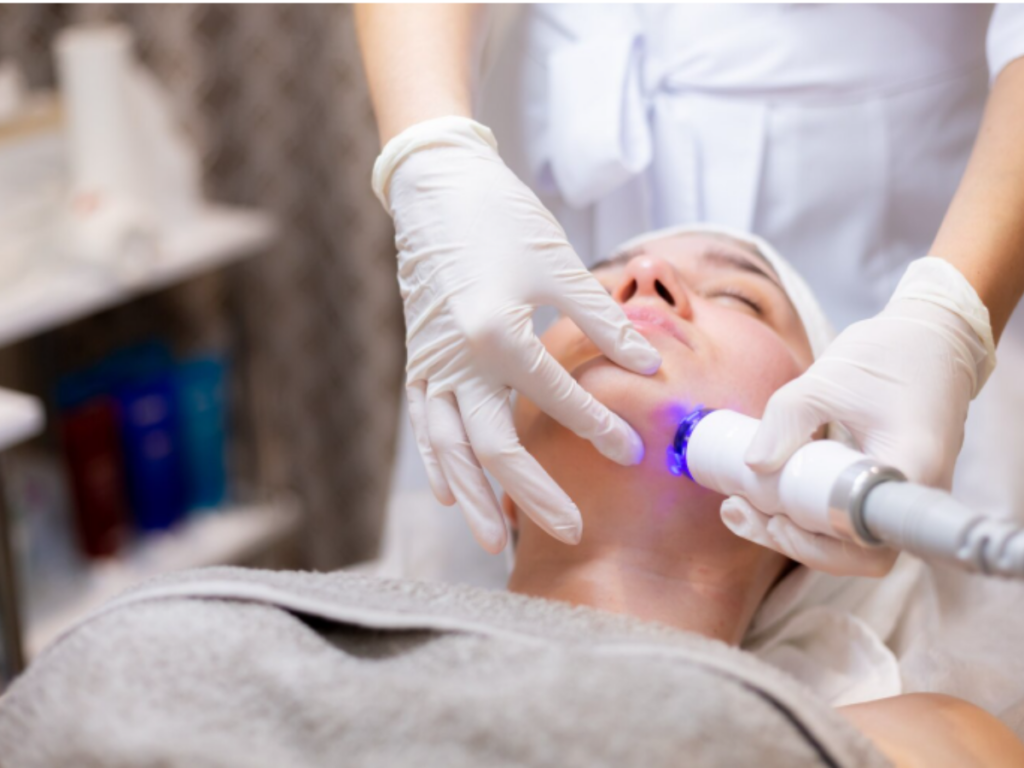 Laser acne treatment for reducing pimples, scars, and improving skin texture