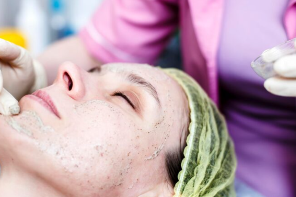 Melasma combination therapy facial treatment with chemical peel and advanced skincare for reducing pigmentation