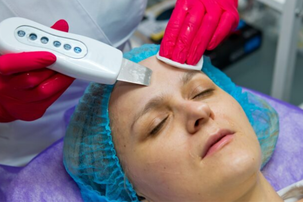 Medical and topical treatments for melasma using dermatologist prescribed creams to reduce facial pigmentation
