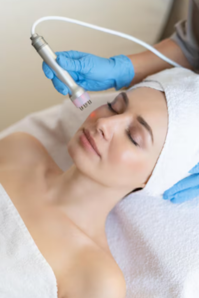 Melasma treatment showing reduction of dark pigmentation patches on face with clear and even skin tone