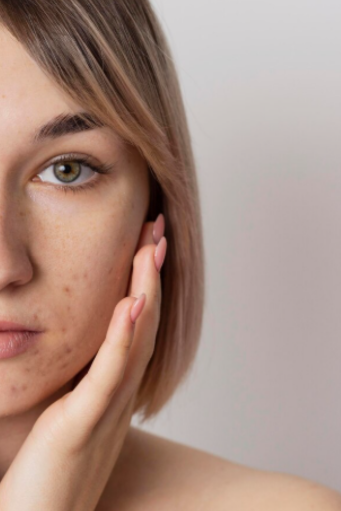 Facial Scars Treatment in Delhi | Smooth & Clear Skin