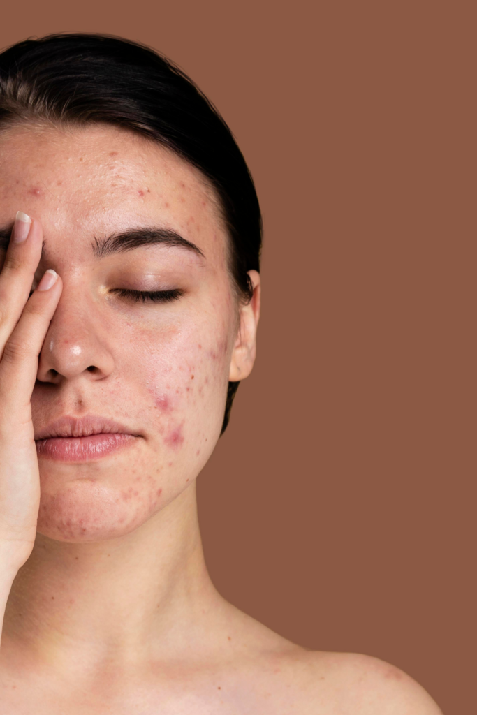 Advanced Facial Scars Treatments in Delhi