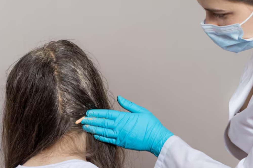 Treatment for dry and oily scalp conditions with expert scalp care