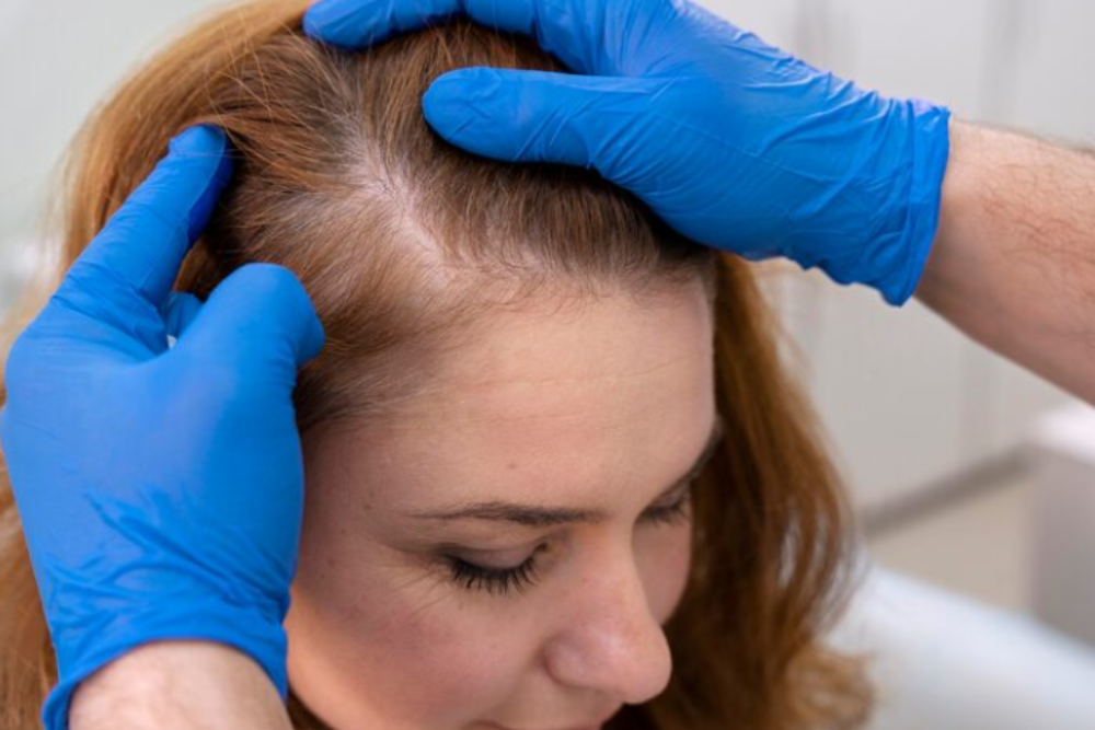 Treatment for hair breakage and weak hair roots