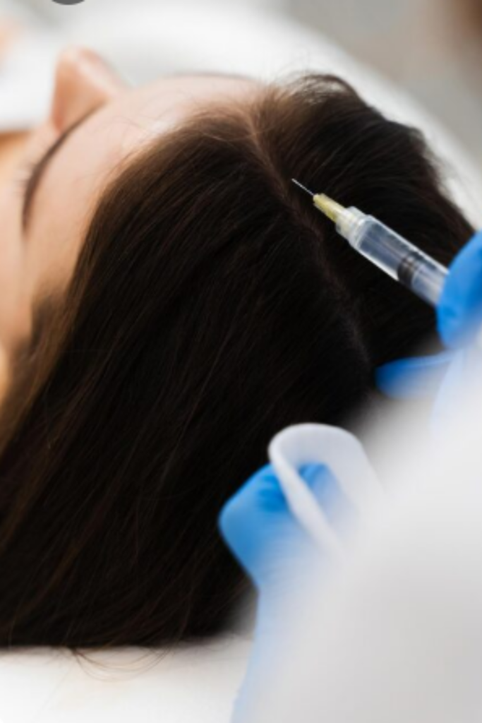Hair GFC Treatment procedure for hair growth and scalp rejuvenation at Emara Skin Clinic