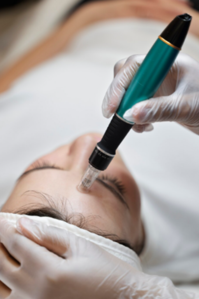 Dermapen 4 Treatment in Delhi for acne scars, pigmentation, and skin rejuvenation