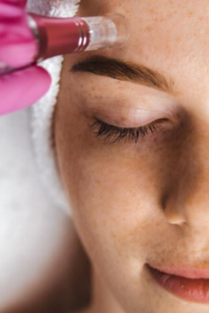 Dermapen 4 Treatment in Delhi for acne scars, pigmentation, and skin rejuvenation