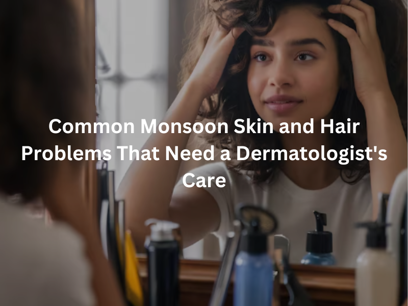 Common monsoon skin and hair problems including acne, dandruff, fungal infections, and hair fall that require a dermatologist's care.