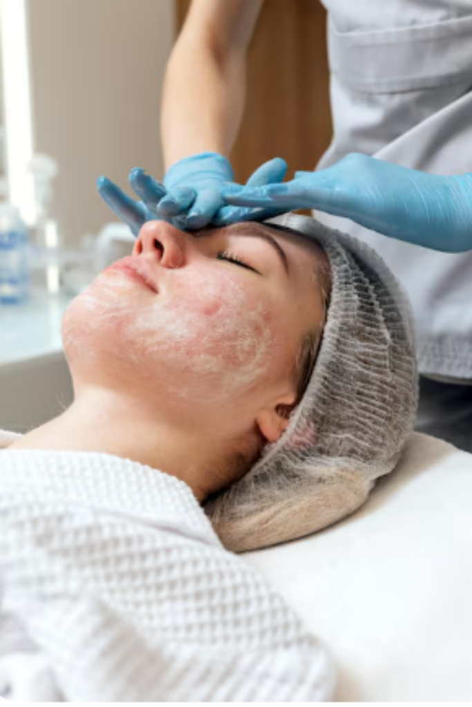 Sensitive Skin Treatment in Delhi by dermatologist for redness and skin irritation