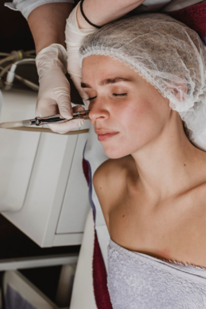 Freckles removal treatment for facial pigmentation