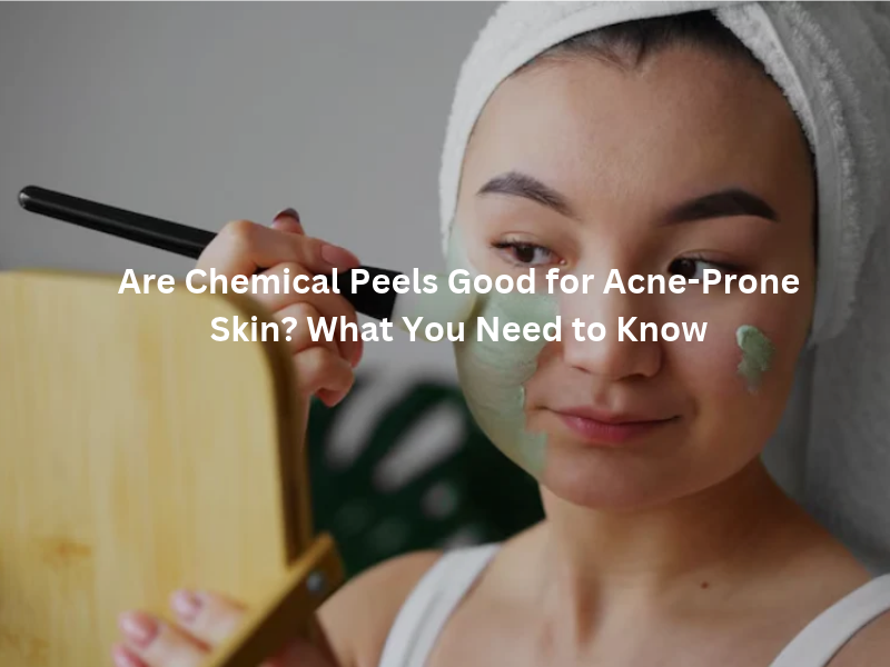 Chemical peel treatment for acne-prone skin in Delhi