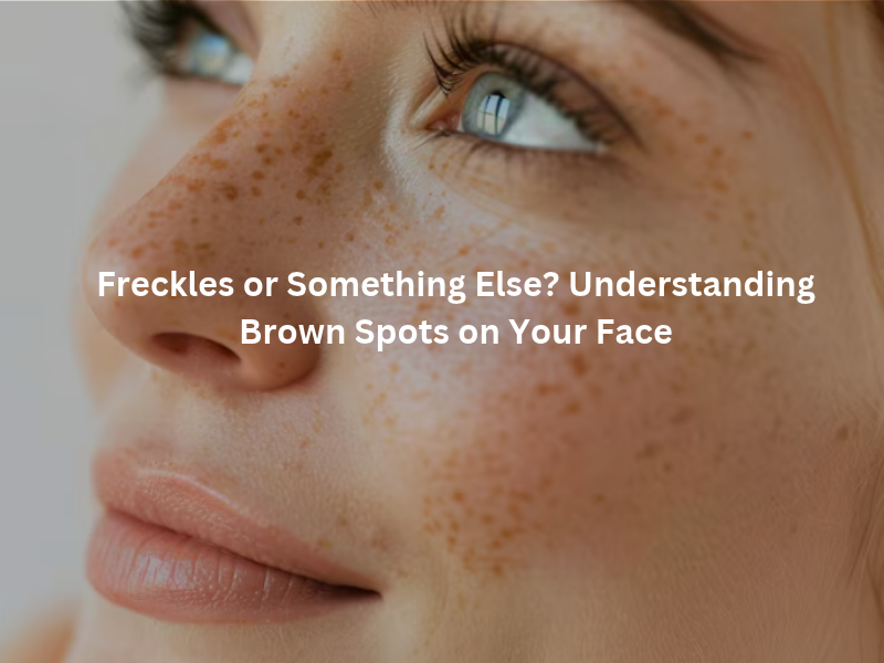 Freckles and brown spots on the face