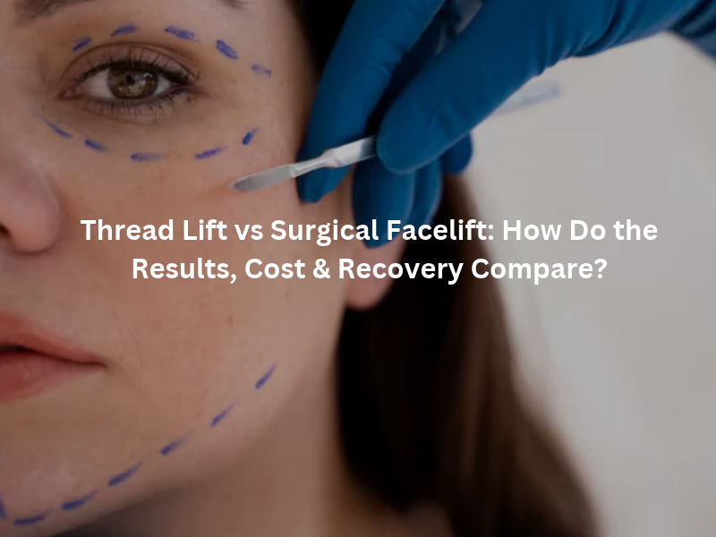 Thread lift vs surgical facelift for facial rejuvenation
